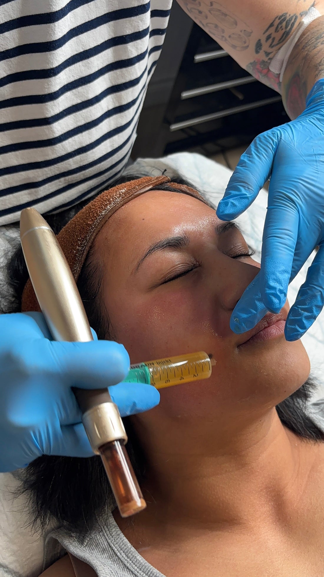 Prp Therapie