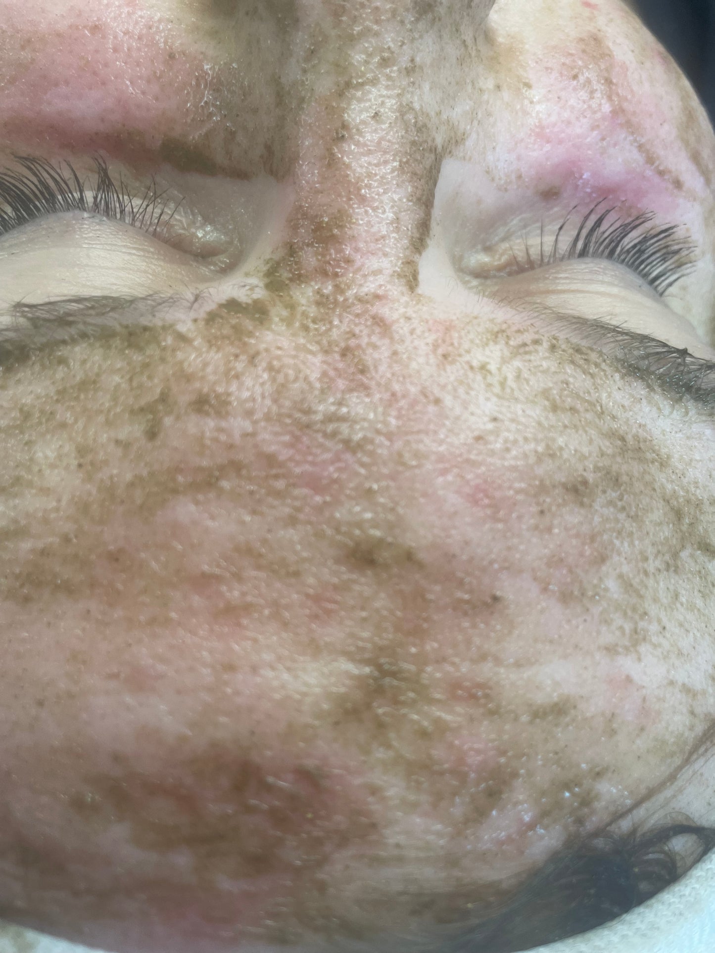Algen Peeling Schulung inkl. Starterset M Paket