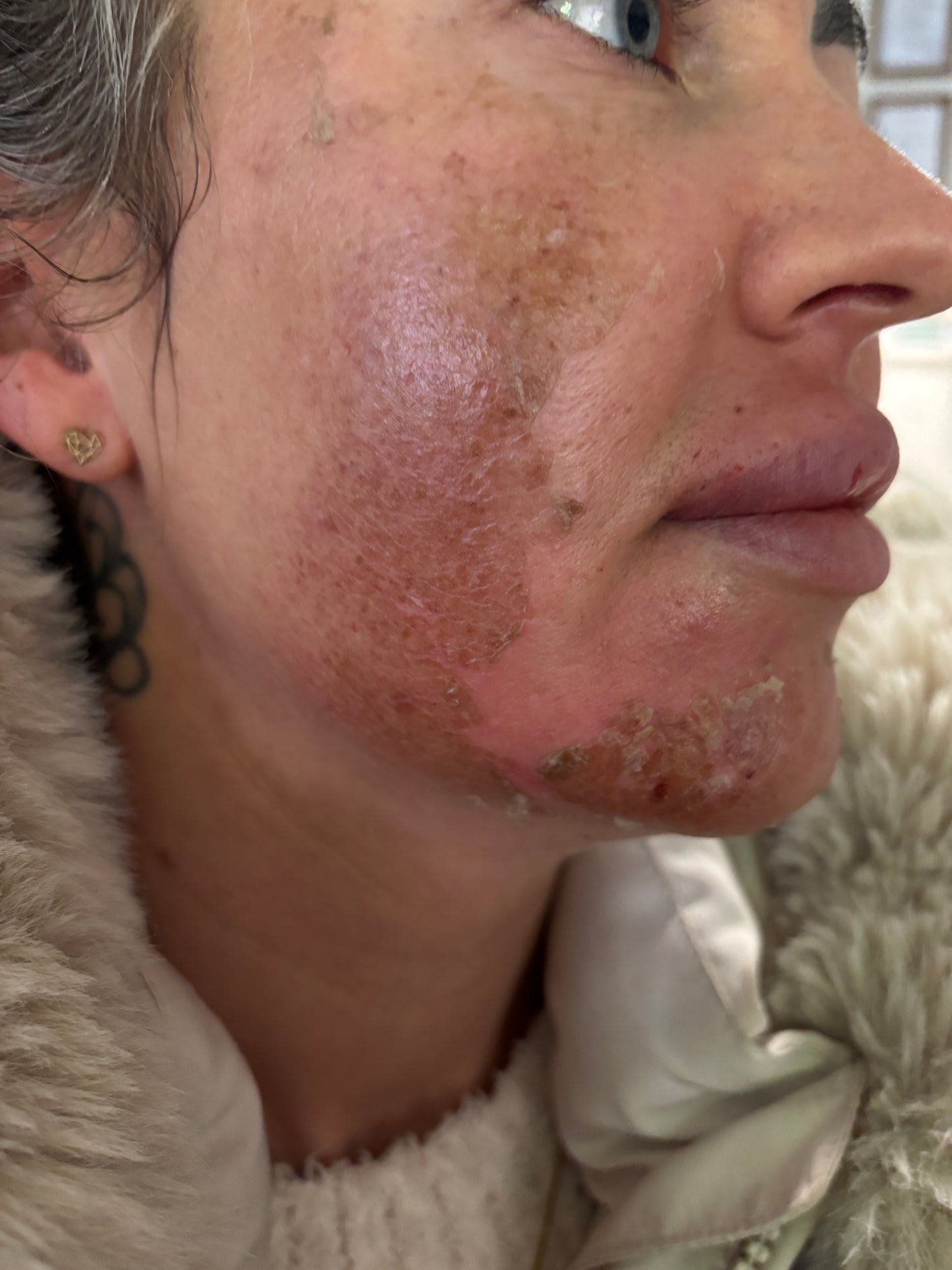 Algen Peeling Schulung inkl. Starterset M Paket