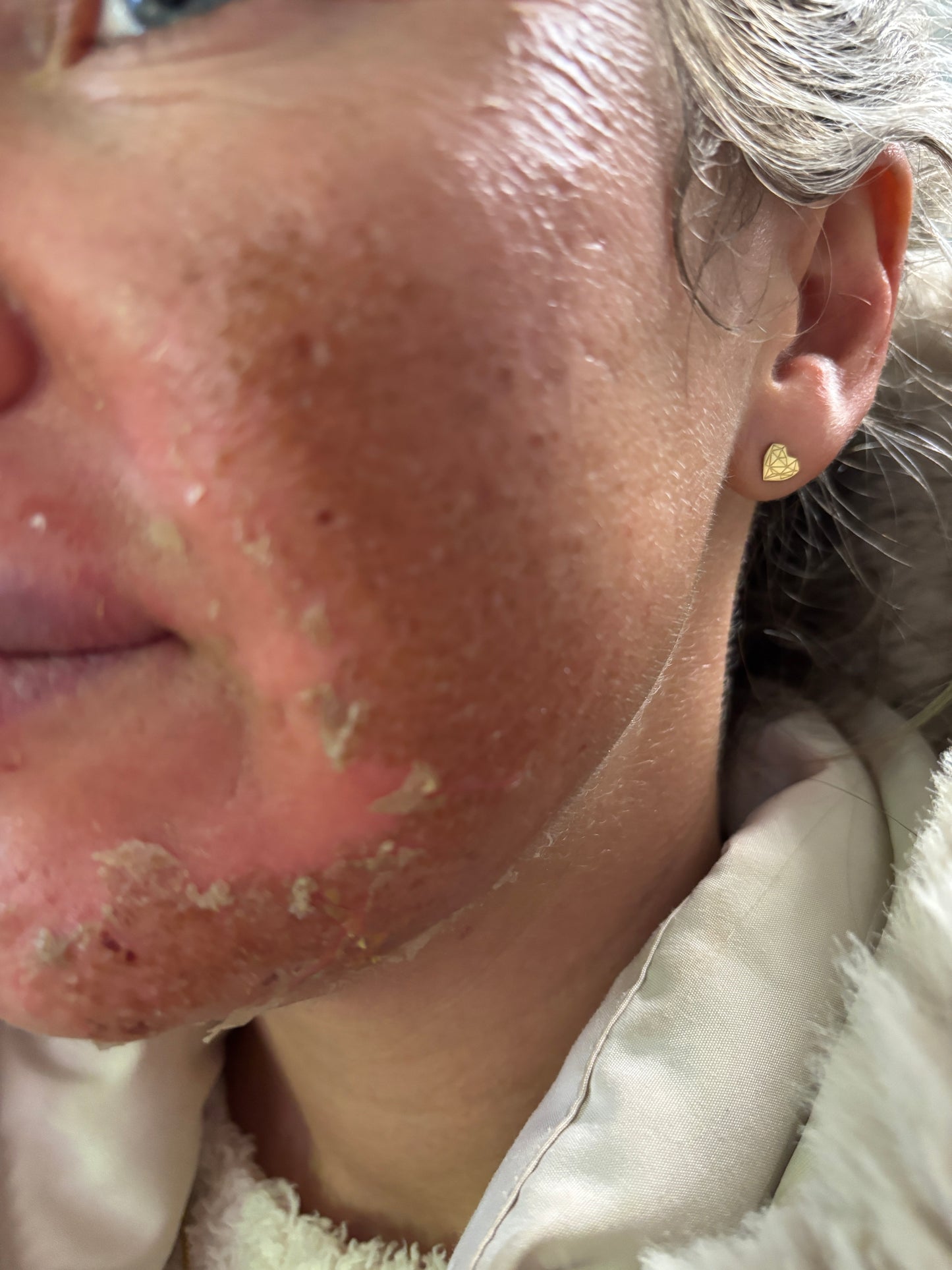 Algen Peeling Schulung inkl. Starterset M Paket