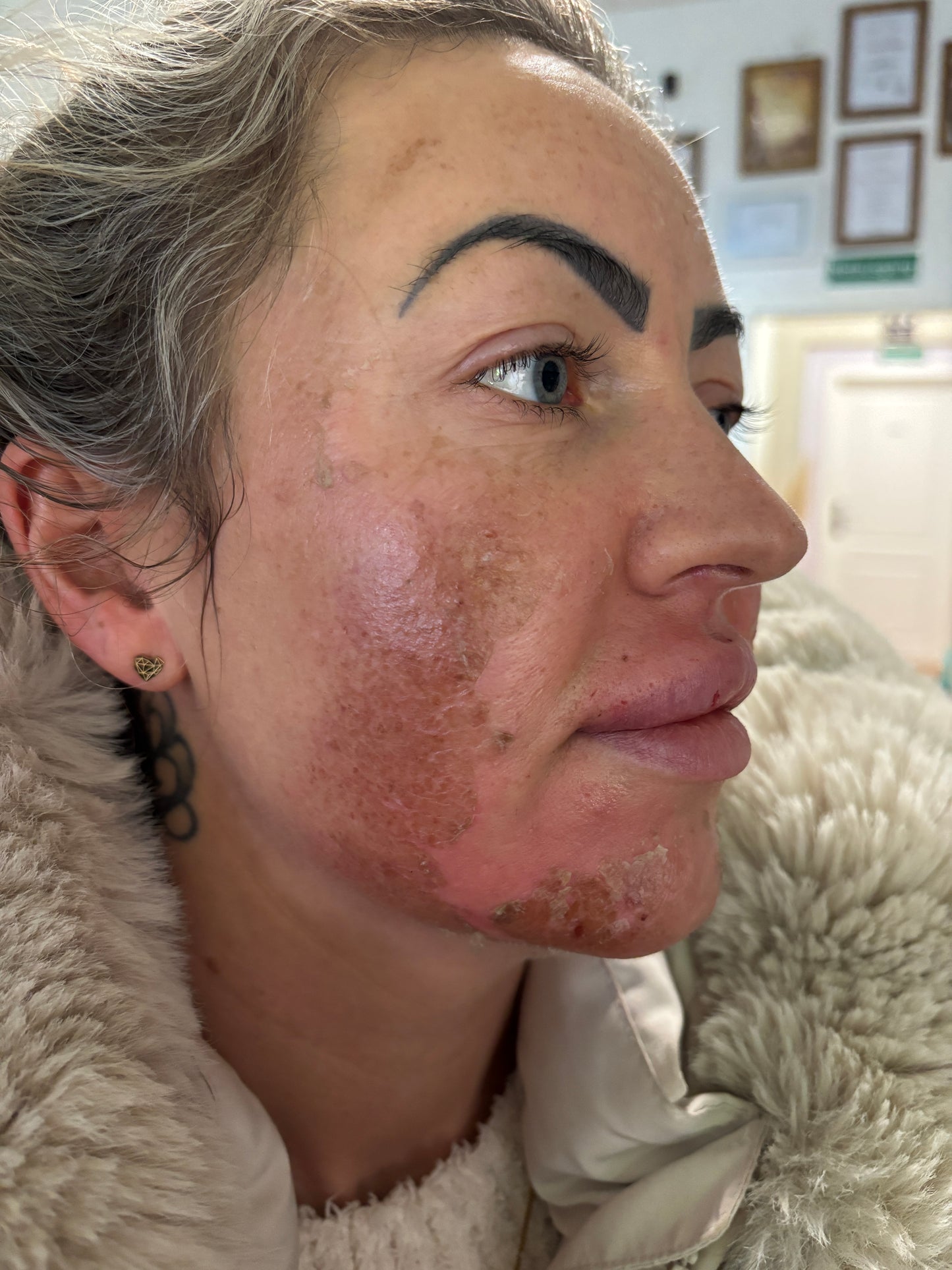 Algen Peeling Schulung inkl. Starterset M Paket