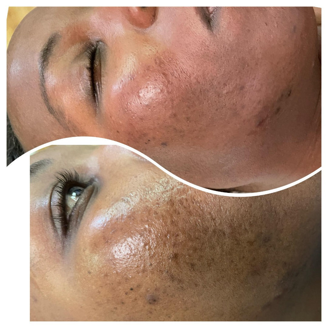 Algen Peeling Schulung inkl. Starterset M Paket