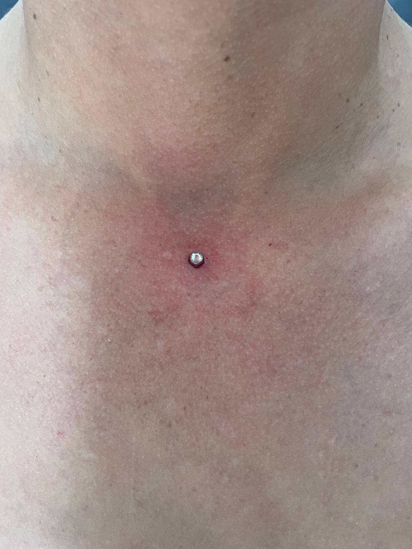 Dermal Anchor Schulung 1Tag