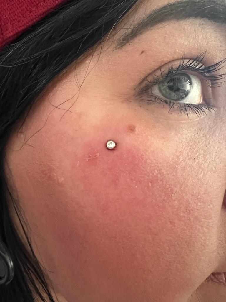 Dermal Anchor Schulung 1Tag