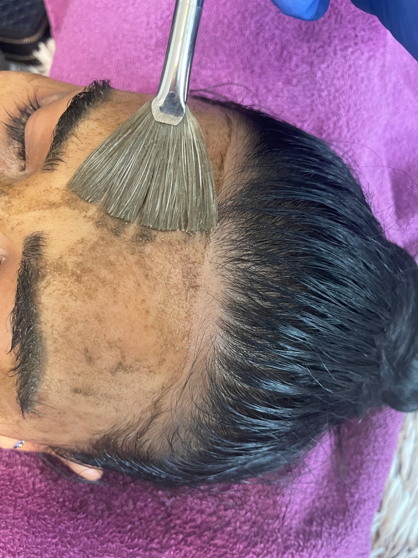 Biomicroneedling Schulung Workshop