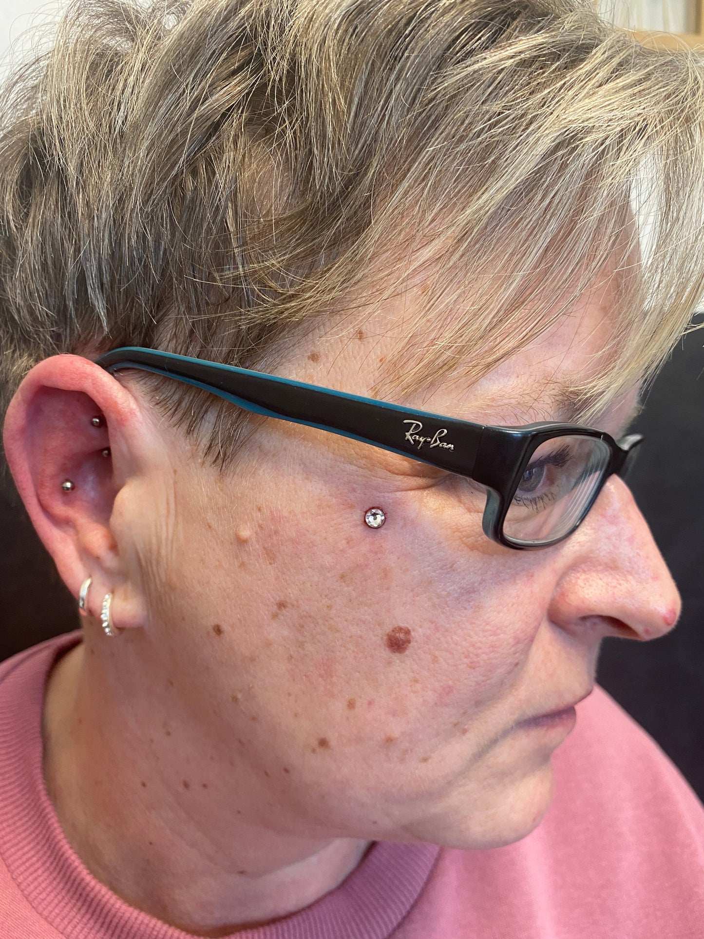 Dermal Anchor Schulung 1Tag