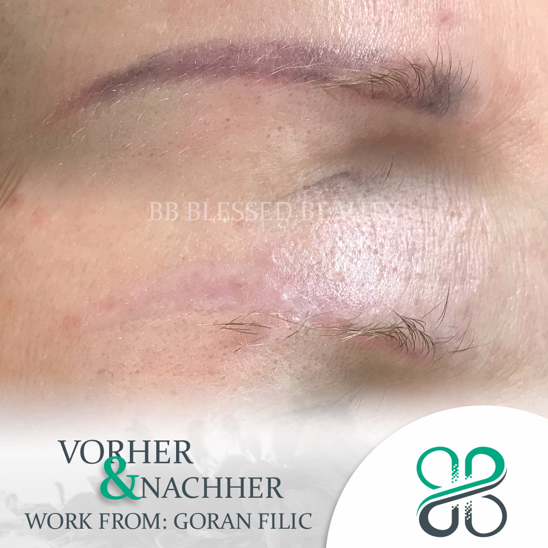 💖 Beauty Blessed Remover Schulung – inkl. Starter-Set! 💖 PMU-Entfernung