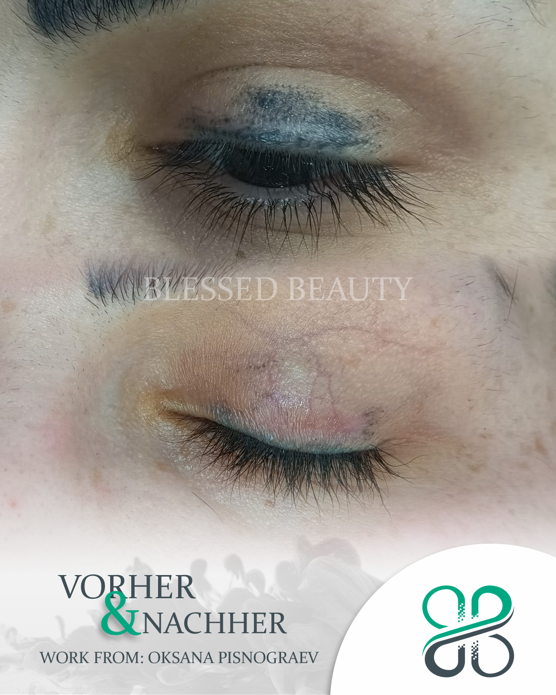 💖 Beauty Blessed Remover Schulung – inkl. Starter-Set! 💖 PMU-Entfernung